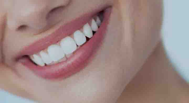 How to Natural Teeth Whitening at Home